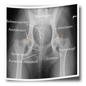Erbkrankheiten